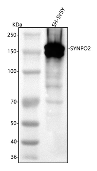 SYNPO2 Rabbit Polyclonal Antibody