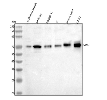 Syncoilin/Sync Rabbit Polyclonal Antibody