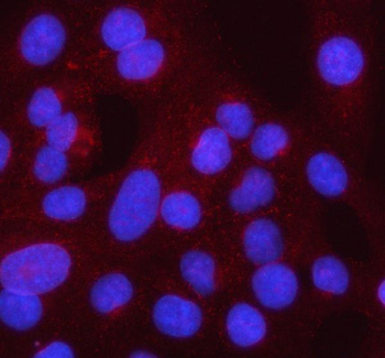 Syncoilin/SYNC Rabbit Polyclonal Antibody