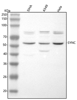 Syncoilin/SYNC Rabbit Polyclonal Antibody
