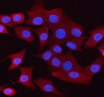 Synaptogyrin 1 Rabbit Polyclonal Antibody