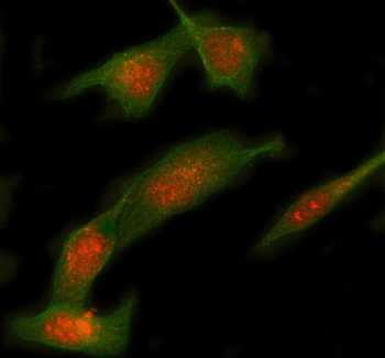 Syntaxin 12/STX12 Rabbit Polyclonal Antibody