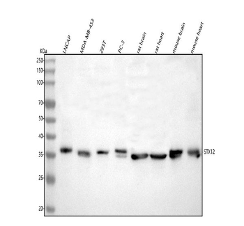 Syntaxin 12/STX12 Rabbit Polyclonal Antibody