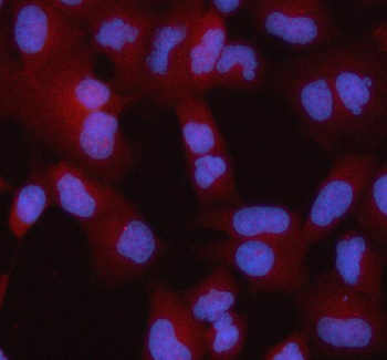 STRBP Rabbit Polyclonal Antibody