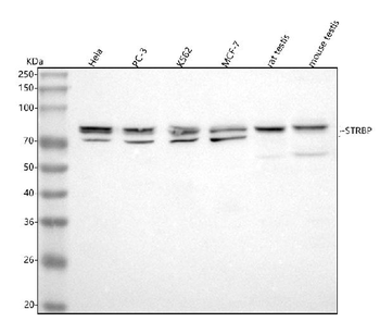STRBP Rabbit Polyclonal Antibody