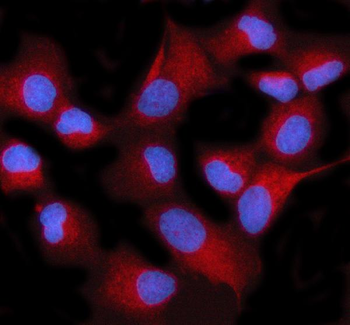 STIM2 Rabbit Polyclonal Antibody