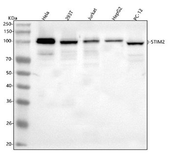 STIM2 Rabbit Polyclonal Antibody