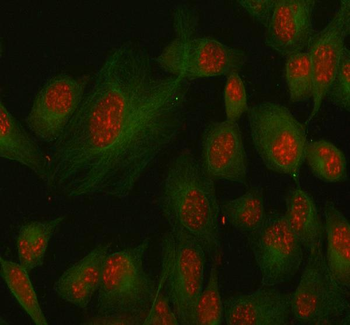 SSH3 Rabbit Polyclonal Antibody