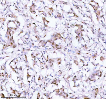 SSH3 Rabbit Polyclonal Antibody