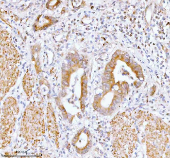 SSH3 Rabbit Polyclonal Antibody
