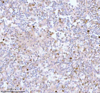 SSH3 Rabbit Polyclonal Antibody