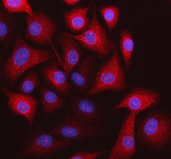 STOML3 Rabbit Polyclonal Antibody