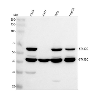 STK32C Rabbit Polyclonal Antibody