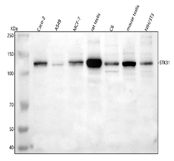 STK31 Rabbit Polyclonal Antibody