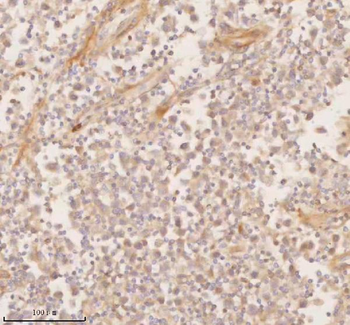 SSSCA1/ZNRD2 Antibody