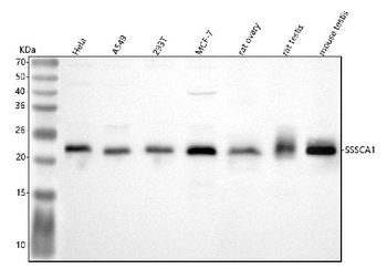 SSSCA1/ZNRD2 Antibody