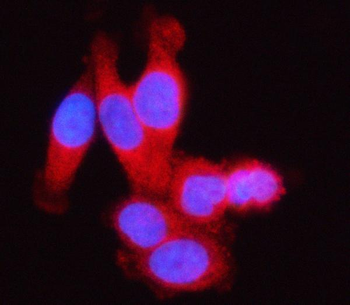 SSSCA1/ZNRD2 Antibody