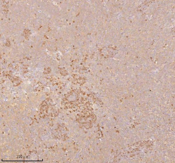 SSSCA1/ZNRD2 Antibody