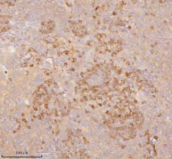 SSSCA1/ZNRD2 Antibody
