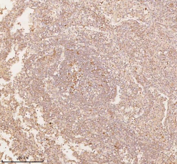 SSSCA1/ZNRD2 Antibody