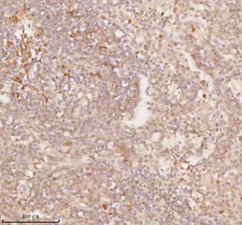 SSSCA1/ZNRD2 Antibody