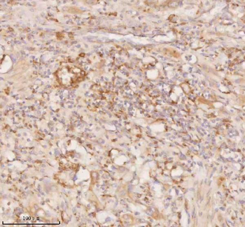 SSSCA1/ZNRD2 Antibody
