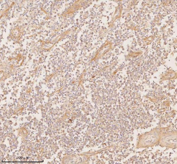 SSSCA1/ZNRD2 Antibody
