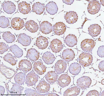 SOAT1 Antibody