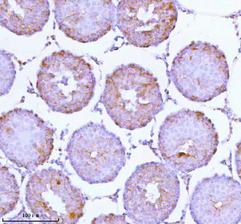 SOAT1 Antibody