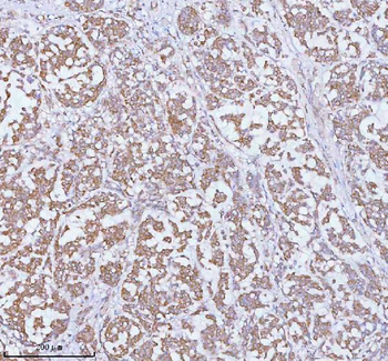 SOAT1 Antibody