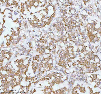 SOAT1 Antibody