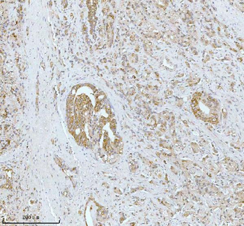 SOAT1 Antibody