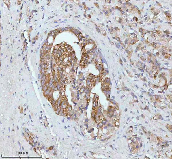 SOAT1 Antibody
