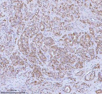 SOAT1 Antibody