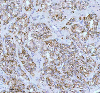 SOAT1 Antibody