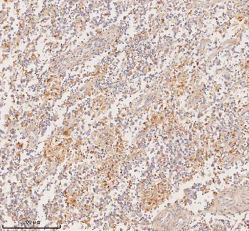 DDX58/RIG-1 Antibody