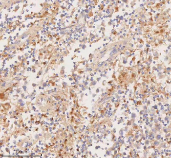 DDX58/RIG-1 Antibody
