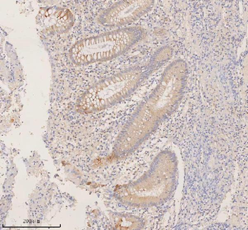 DDX58/RIG-1 Antibody