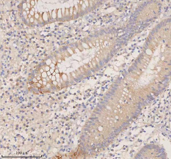 DDX58/RIG-1 Antibody