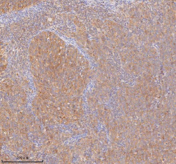 DDX58/RIG-1 Antibody