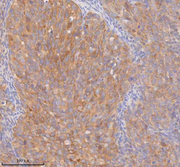 DDX58/RIG-1 Antibody
