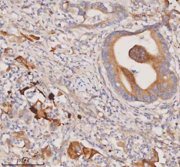 DDX58/RIG-1 Antibody