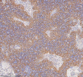 DDX58/RIG-1 Antibody