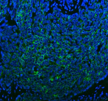 SPA17 Antibody