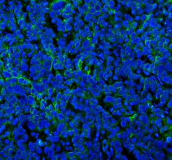 SPA17 Antibody