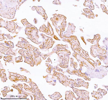 SPA17 Antibody