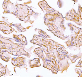 SPA17 Antibody