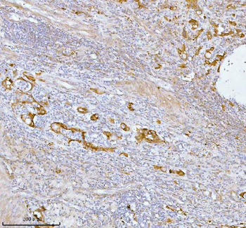 SPA17 Antibody