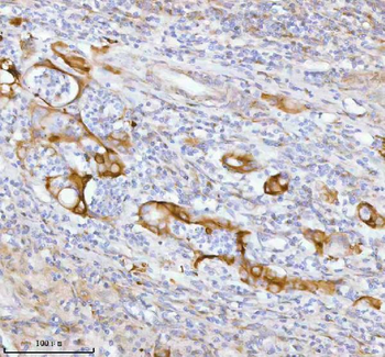 SPA17 Antibody