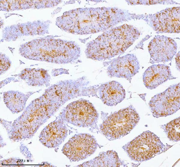 SPA17 Antibody